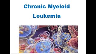 Chronic Myeloid Leukemia of 5th WHO Edition [upl. by Nnelg419]