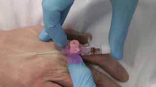 Cannulation How to gain IV access [upl. by Nilcaj]