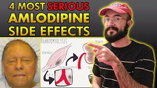 4 Most SERIOUS Amlodipine Side Effects [upl. by Ahsimek102]