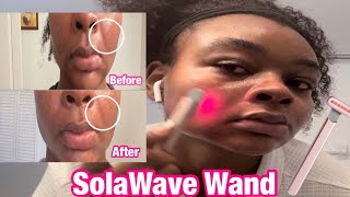 SolaWave Review  Tutorial Results in 2 Weeks Before  After [upl. by Juta]