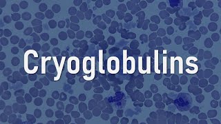 Cryoglobulins [upl. by Goulet482]