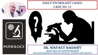 DAILY PATHOLOGY CASES CASE NO 12 Dr Wafaey Badawy [upl. by Richela]