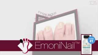 EmoniNail Toenail Fungus Treatment  Video Review [upl. by Yrogerg]