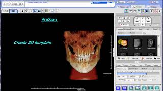 PreXion Training Tips Create a 3D template [upl. by Fredia]