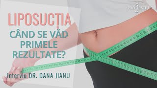 Când se văd primele rezultate după lipoaspiratieliposuctie Interviu Dr Dana Jianu  🥇ProEstetica [upl. by Blumenfeld]