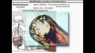 Verminoses causadas por nematelmintos [upl. by Agnizn525]