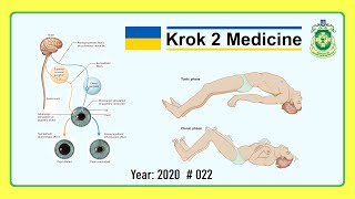 Krok 2 Medicine  Year 2020  022 Ministry of Public Health of Ukraine [upl. by Bisset615]