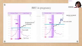 Tracking Your Basal Body Temperature  BBT Basics with Monica NFP Instructor [upl. by Einnalem]