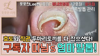 ENG SUB엄마의 발톱관리 구독자 따님께서 엄마 모시고 오셨어요 효도와 직관 두마리 토끼를 잡다 ingrown toenail  Fresh Foot 풋풋한리쌤 성수점 [upl. by Hedda]