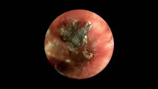 Ear Mites Inside Dog’s Ear Canal Video Otoscopy [upl. by Gildas]