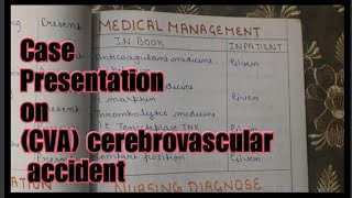 cerebrovascular accidentcase presentationstroke [upl. by Eirised]