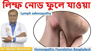 লিম্ফ এডিনোপ্যাথি। লিম্ফ নোড ফুলে যাওয়া । Lymph adenopathy ।হোমিওপ্যাথিক চিকিৎসা । Dr Abdul Mannan [upl. by Einoj]