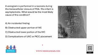 Venogram in a Neonate During PDA Closure  NICU [upl. by Gnort]