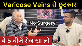 Varicose Veins Treatment in Ayurveda  How to Cure Varicose Veins Problem  The Health Show [upl. by Hploda841]