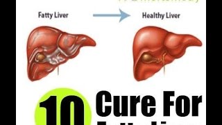 Alagaan ang ATAY at Kidney Hepatitis Fatty Liver Liver Cancer  ni Doc Willie at Liza Ong 298 [upl. by Tolman187]