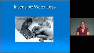 Neonatal Intensive Care Exam Review Electrolyte Disturbances  MEDED [upl. by Sifan]