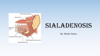 Sialadenosis  causes pathophysiology [upl. by Tikna521]