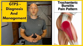 Greater Trochanteric Pain Syndrome Diagnosis and Treatment [upl. by Virgilio852]