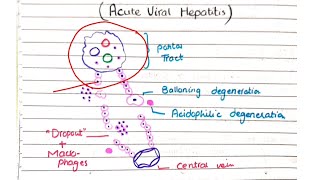 Acute and Chronic Viral Hepatitis  Pathology [upl. by Zilada]