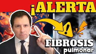 ALERTA ⚠️ CIENTÍFICOS REVELAN QUE INCIDENCIA DE FIBROSIS PULMONAR INCREMENTARÍA POR COVID19 [upl. by Natek365]