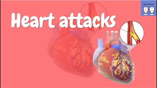 What is a heart attack Pathophysiology STEMI NSTEMI ECG interpretation Diagnosis Symptoms [upl. by Einnov]