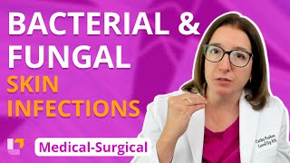 Bacterial amp Fungal Skin Infections Integumentary System  MedicalSurgical  LevelUpRN [upl. by Anton]