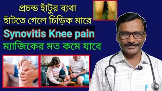 Synovitis knee pain  joint lining inflammation  হাঁটু ব্যথার দ্রুত উপশম  Dr SP Goswami [upl. by Enohs]