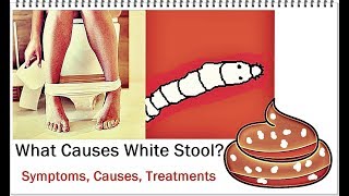 White Poop Change in Color of Bowel Movement  Causes [upl. by Nov]