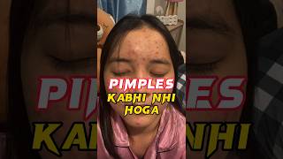 Day 3290 👌👌😍😍 Pimples Treatment  Pimples Removal at Home Remedy Without Money  Hindi shorts [upl. by Eskill]