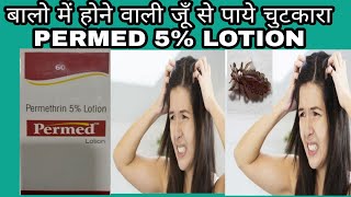 Permed Lotion full review in Hindi  परमेड लोशन रेवयु इन हिंदी [upl. by Kus]