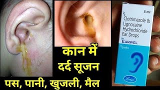 Earwel Ear Drops uses side effects in hindi earwel ear drop use hindi [upl. by Lamiv451]