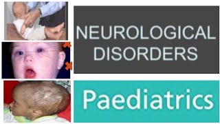 12 Neurological Disorders Paediatrics  Cerebral Palsy [upl. by Levon]