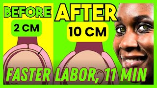 How to Dilate Cervix Faster Cervix Opening Exercise  DOCTOR V  S1E4 [upl. by Assirek]