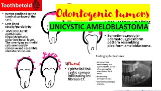 Unicystic ameloblastoma  Odontogenic tumors Oral pathology  Ameloblastoma [upl. by Aronal907]