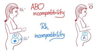 ABO incompatibility vs Rh incompatibility [upl. by Joed987]