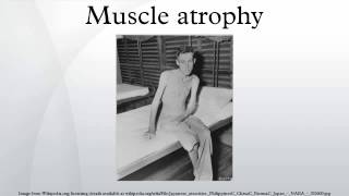 Muscle atrophy [upl. by Aileek289]