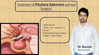 Pituitary Adenoma  Non Surgical treatment Cure without Operation Prolactinoma By Dr SkandaNSx [upl. by Godewyn329]