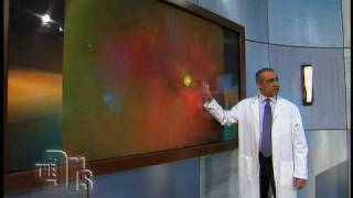 The Optomap® Retinal Exam on The Doctors [upl. by Meeks]