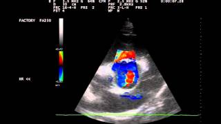 Herzultraschall Aortenklappeninsuffizienz beim Pferd [upl. by Serrell]