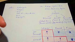 Cirrosis Hepática ESQUEMA FÁCIL [upl. by Ludvig]