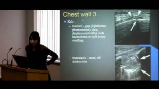 Chest Ultrasound Anatomy amp Pathology [upl. by Ecnadnac222]