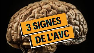 Les 3 signes de lAVC en 1 minute [upl. by Delores]