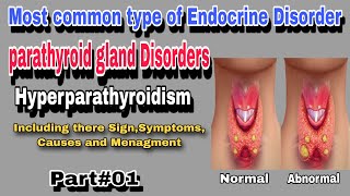 Hyperparathyroidism  Parathyroid gland Disorder By AbuBakar Med Plus [upl. by Ellessig658]