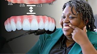 Why Is There a  with Dental Implants [upl. by Ahsinek]