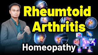 Rheumtoid Arthritis Chronic Inflammatory Arthritis  Dr Bharadwaz  HomeopathyTreatment and Cure [upl. by Nedarb]