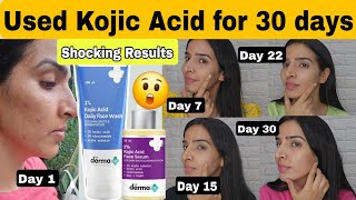 Used Derma co Kojic acid face wash and serum for 30 days 😳 Shocking Results 😨 [upl. by Abott]