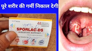 यह 2 ₹ गोली पस्त पेचिश मुह के छाले पेट की इन्फेक्शन ठीक करेगी  Sporlac Ds Tablets Uses in Hindi [upl. by Hairehcaz]