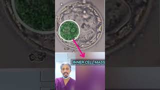 इंसान के पांच दिन का Embryo कैसा दिखता है  Have you Ever seen Day5 Human embryo [upl. by Hawger436]