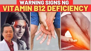 9 Warning Signs na Kulang Ka sa Vitamin B12  By Doc Willie Ong Internist and Cardiologist [upl. by Idnic]