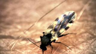 Midge bites through presenters arm  The Secret Life of Midges  BBC One [upl. by Anitsihc]